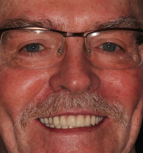 Img-before-and-after - AFTER 12