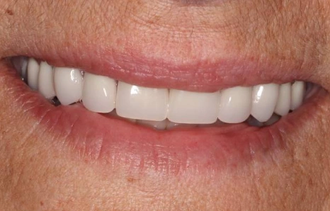 Img-before-and-after - AFTER 5