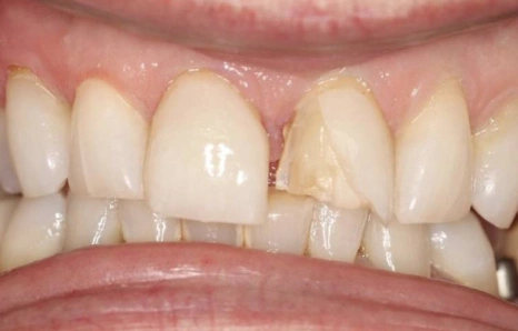 Img-before-and-after - BEFORE 1