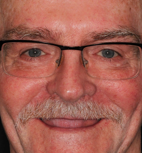 Img-before-and-after - BEFORE 12