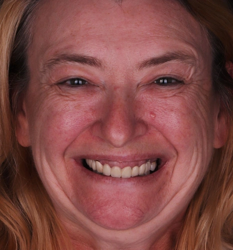 Img-before-and-after - BEFORE 14