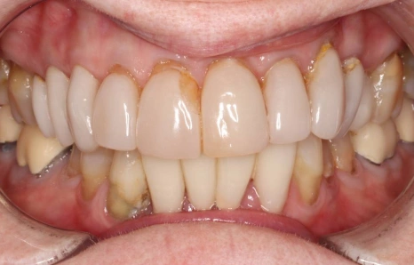 Img-before-and-after - BEFORE 2