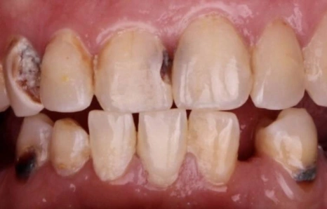 Img-before-and-after - BEFORE 4