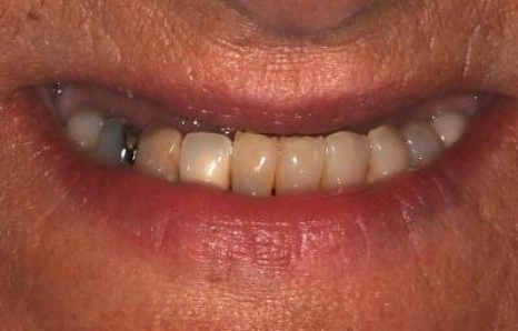 Img-before-and-after - BEFORE 5