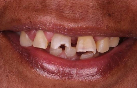 Img-before-and-after - BEFORE 6