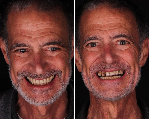 When to Choose Same-Day Dental Care